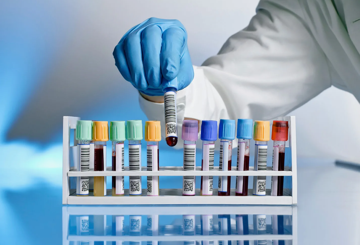 Новая схема мошенничества с анализами повергает людей в шок!