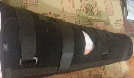 Друзья познаются в беде: одна нога на пять подруг