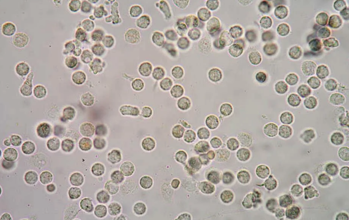 Зачем врач назначает анализ мочи по Нечипоренко?