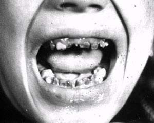 Продолжение моей автобиографической повести