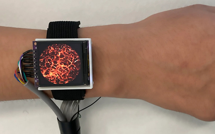 Революционное фотоакустическое устройство: Визуализация кровотока в удобном корпусе, подобном наручным часам