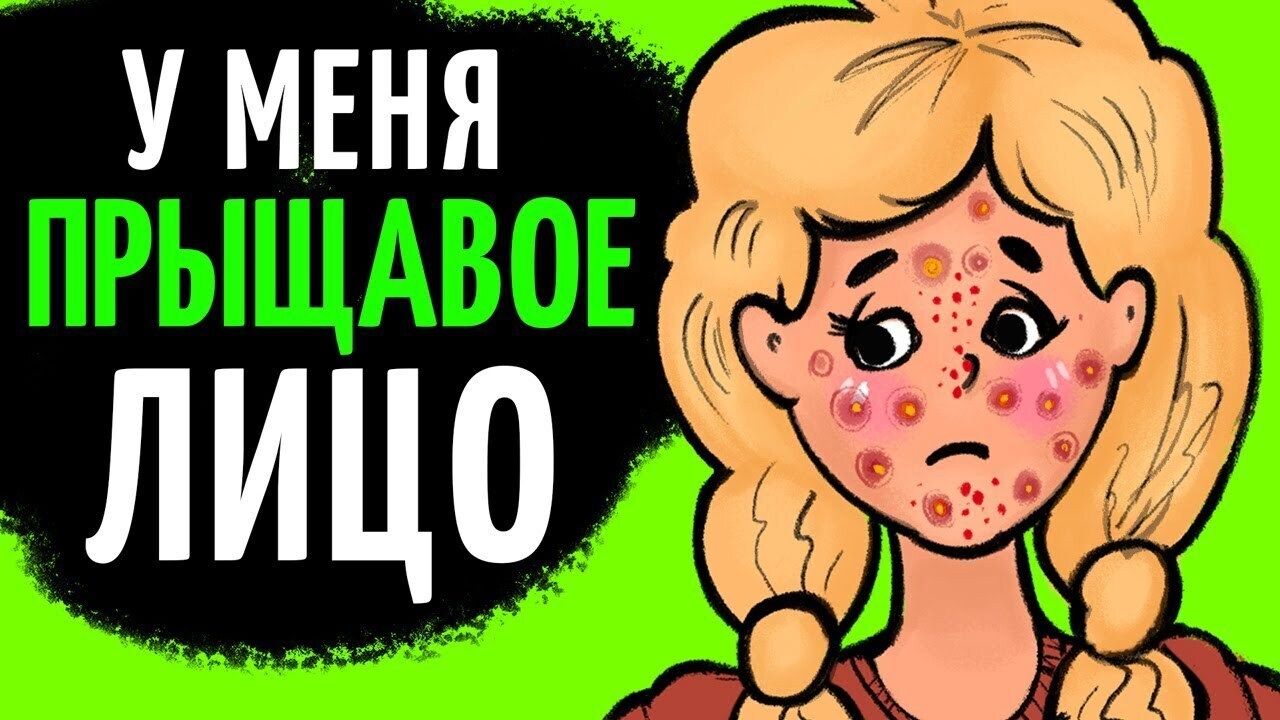 Весенняя Радость: Как Справиться с Прыщами на Лице