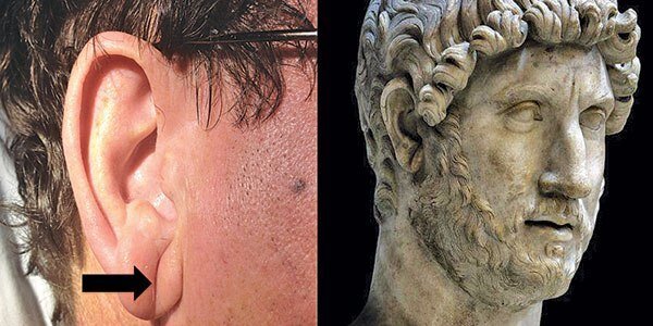 Знак Фрэнка