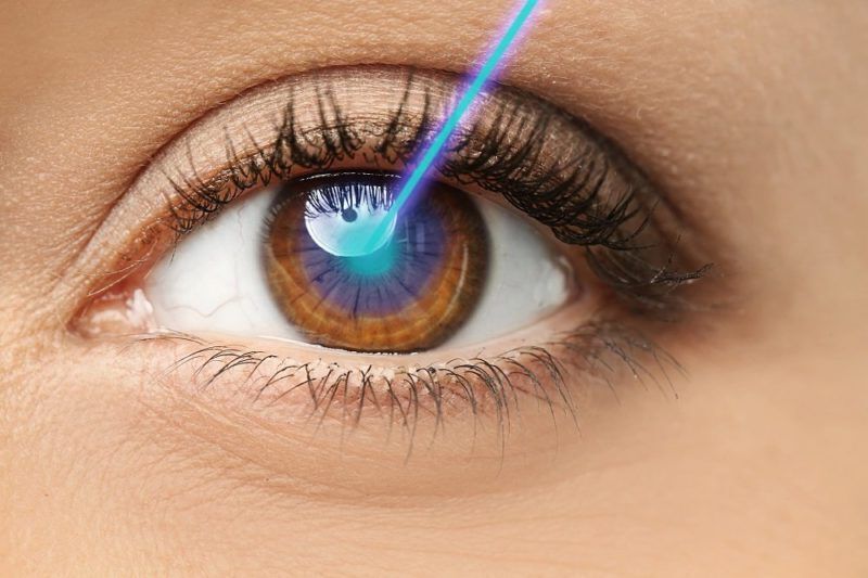 Лазерная хирургия глаза: преимущества и ограничения
