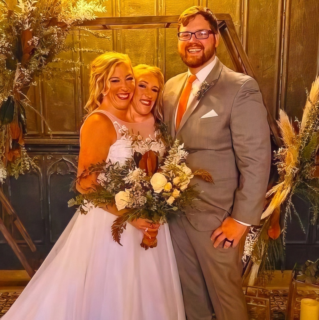 Одна из сиамских близняшек Эбигейл Хенсел вышла замуж.