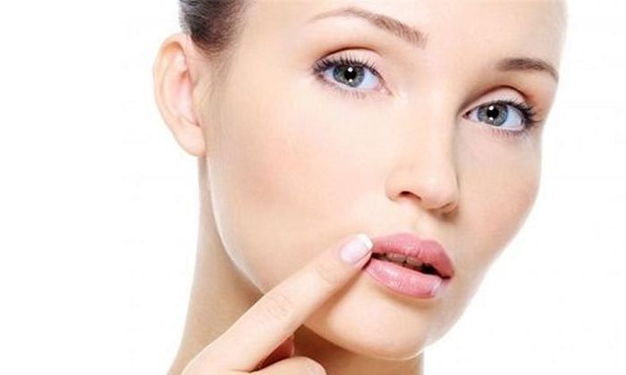 Герпес на губах: симптомы и лечение