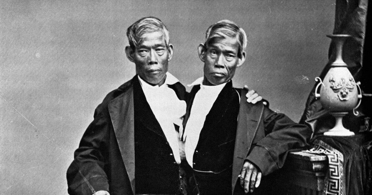 Жизнь сиамских близнецов: владевших фермой, двумя женами и 21 ребенком