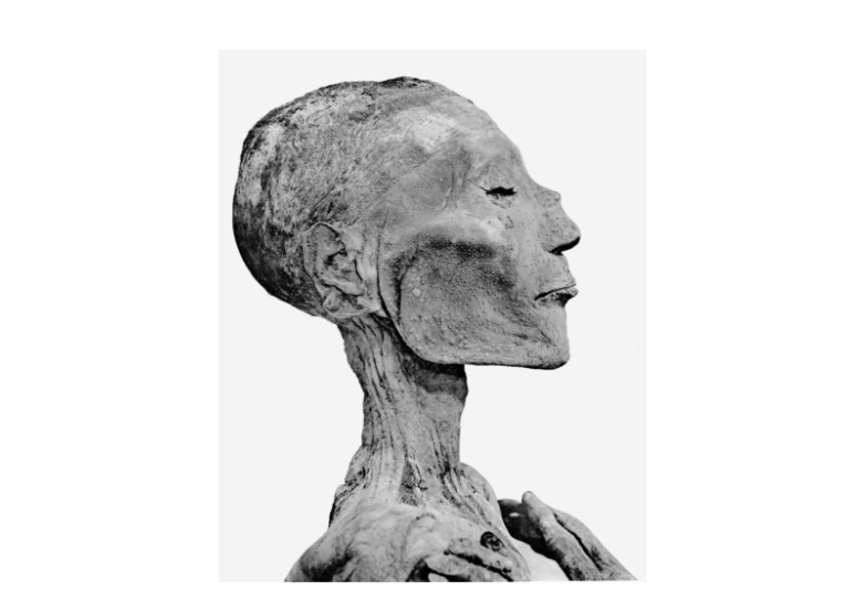 Топ 4 Эпидемий в Нашей Истории