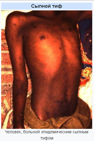 Топ 4 Эпидемий в Нашей Истории