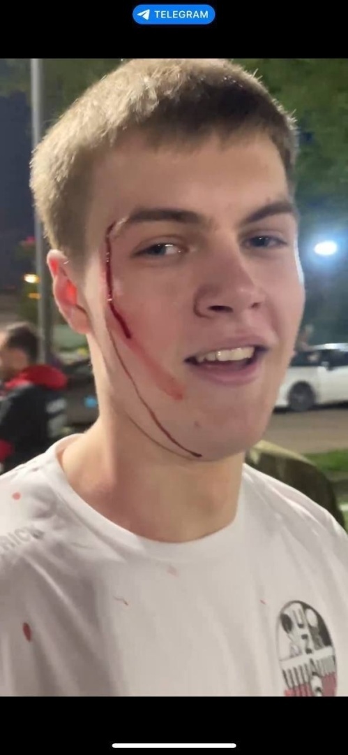 Уроженцы Средней Азии превратили футбольный матч в рукопашку из подтишка, после проигранного матча