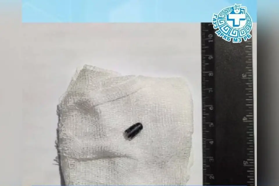 Думали обычный кашель, но то, что обнаружили врачи у 4-летнего ребенка, удивило