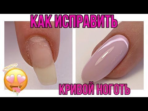 Как исправить кривой ноготь .