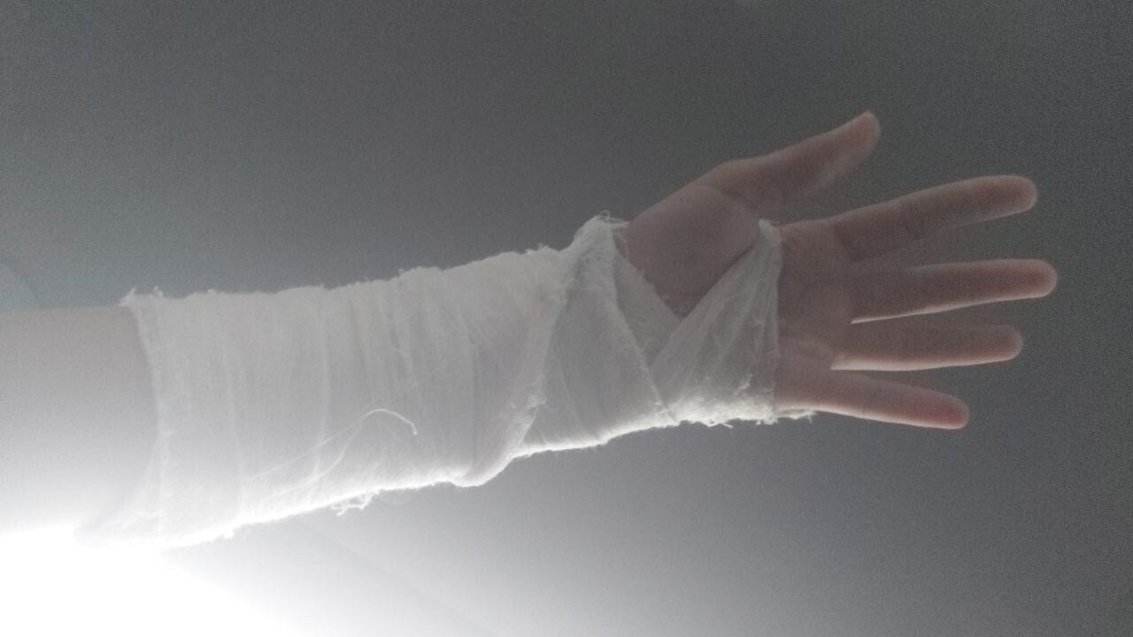 Сломали руку? Так это Ваши проблемы!