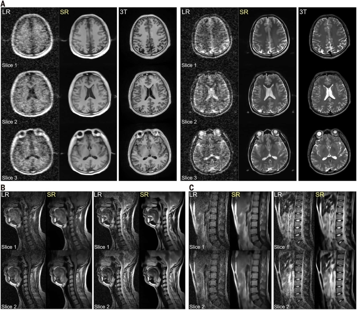 Инженеры из Китая разработали прототип дешевого МРТ-сканера