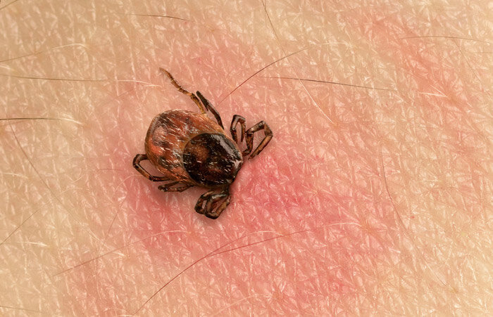 Опасное лето. Когда начнет снижаться активность клещей?