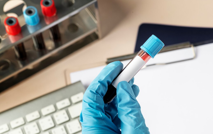 "Ни шиша не показывают"- Владимир Путин резко высказался о российских тест-системах для диагностики заболеваний⚡⚡⚡