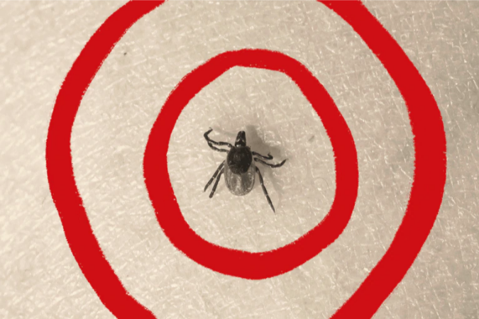 Что говорят последние научные данные о болезни Лайма