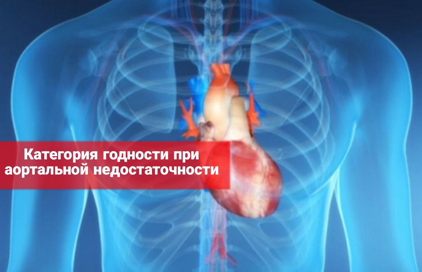 Берут ли в армию с аортальной недостаточностью