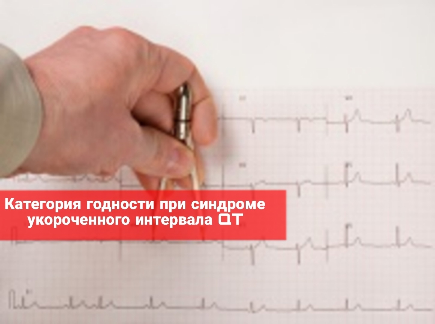 Категория годности при синдроме укороченного интервала QT