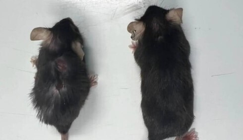 Таблетка от старости стала реальностью? Новая разработка может прибавить человеку 5-10 лет жизни