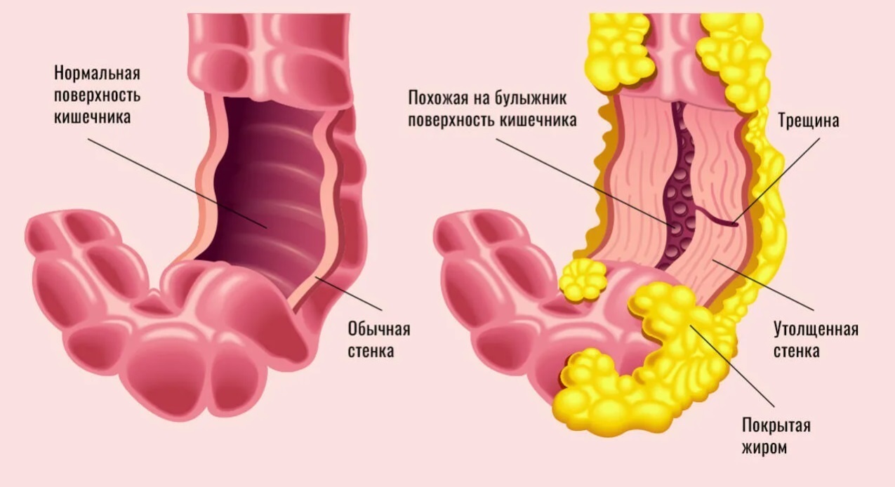 Факты, которые Вас не убедят ибо убогие не исправимы, а правда бессильна.