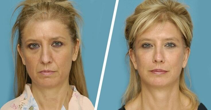 Даже в 20 можно выглядеть старым. Неочевидные маркеры старости, которыми многие пренебрегают