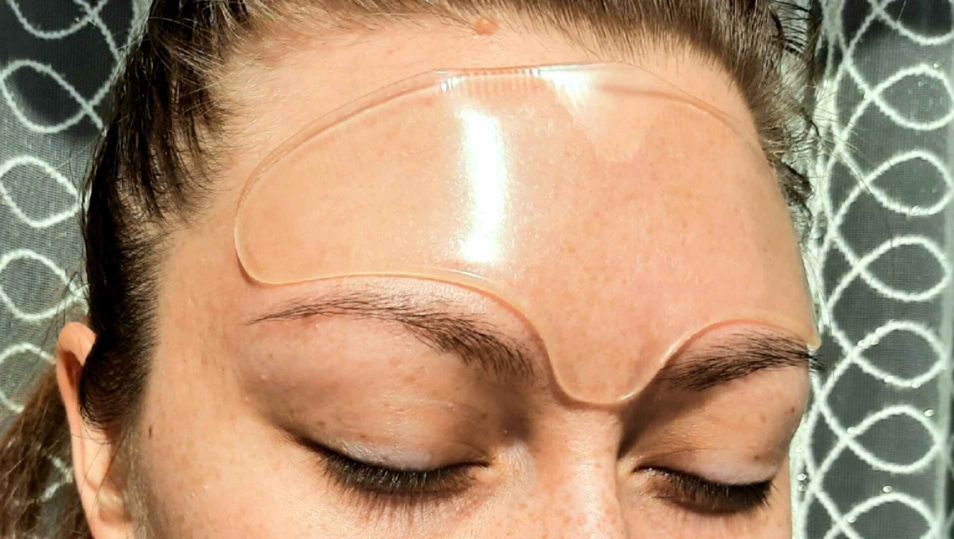 Избавилась от межбровки без уколов и дорогостоящих процедур