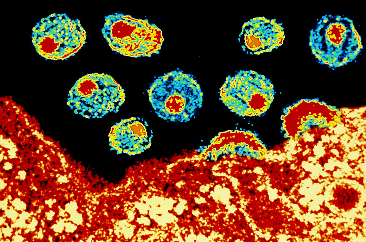 Новая эра в лечении ВИЧ: Вирус борется с вирусом