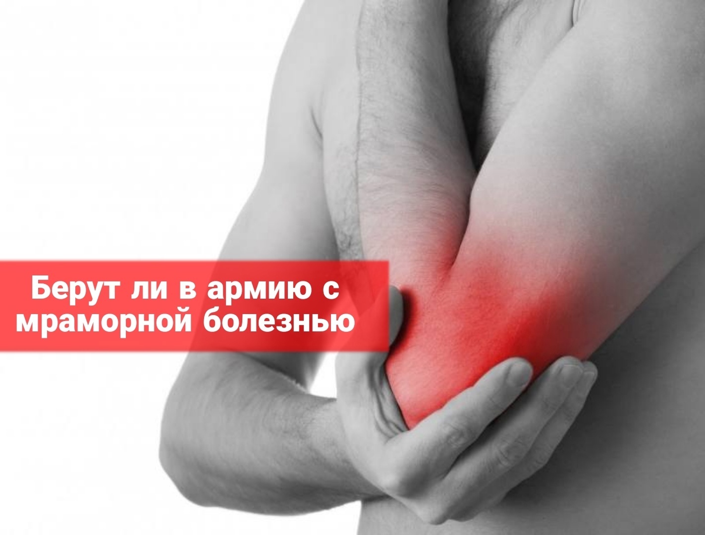 Берут ли в армию с мраморной болезнью