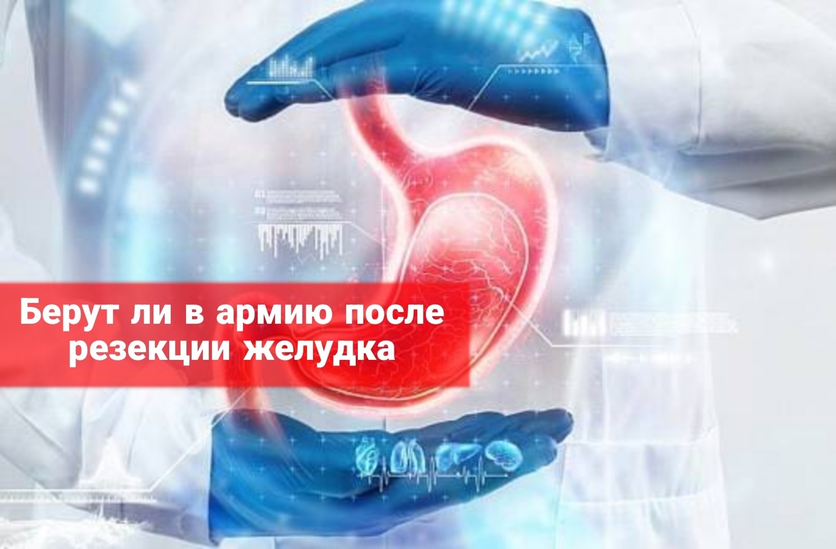 Берут ли в армию после резекции желудка