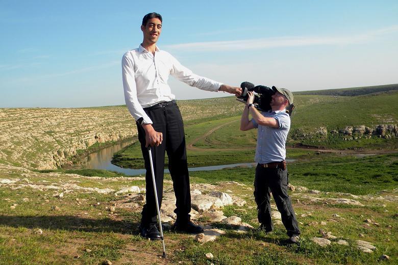 10 страшных болезней, которые безжалостно уродуют людей.