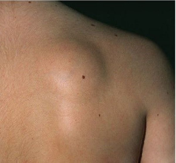 10 страшных болезней, которые безжалостно уродуют людей.