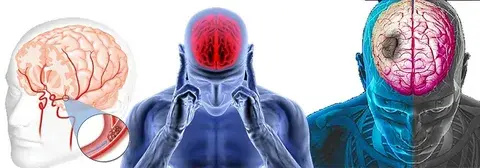 Сердце. Наиболее опасные болезни для старшего поколения.