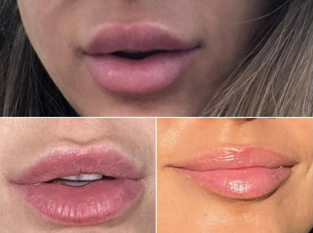 Не поверишь! Губы - "уточки" больше не в тренде. Вот это да! 😲