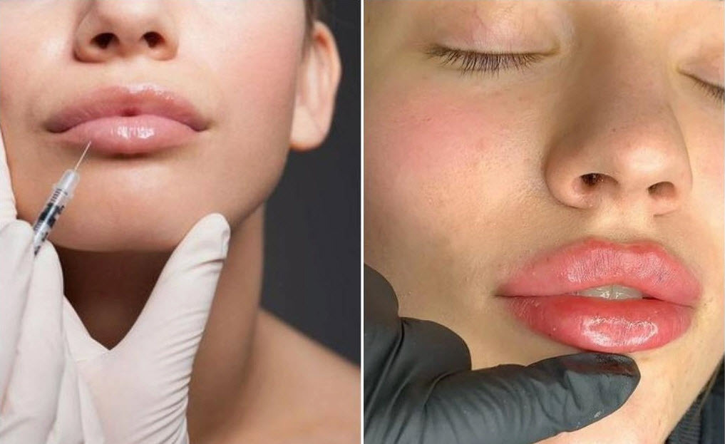 Не поверишь! Губы - "уточки" больше не в тренде. Вот это да! 😲