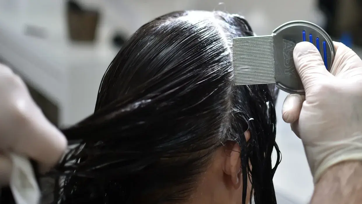 Покалывание ползания: как можно бороться с головными вшами