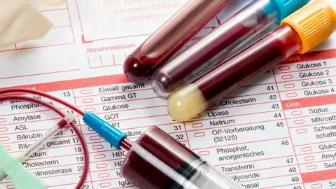 Сахар в крови. Анализ.