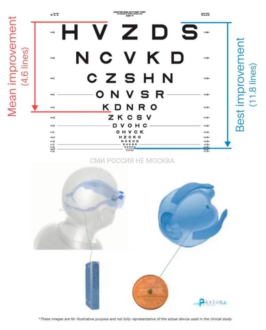 Впервые в истории учёные победили слепоту