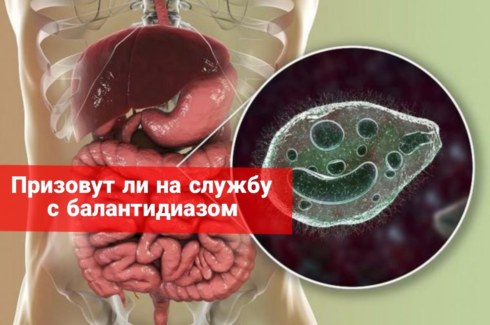 Призовут ли на службу с балантидиазом