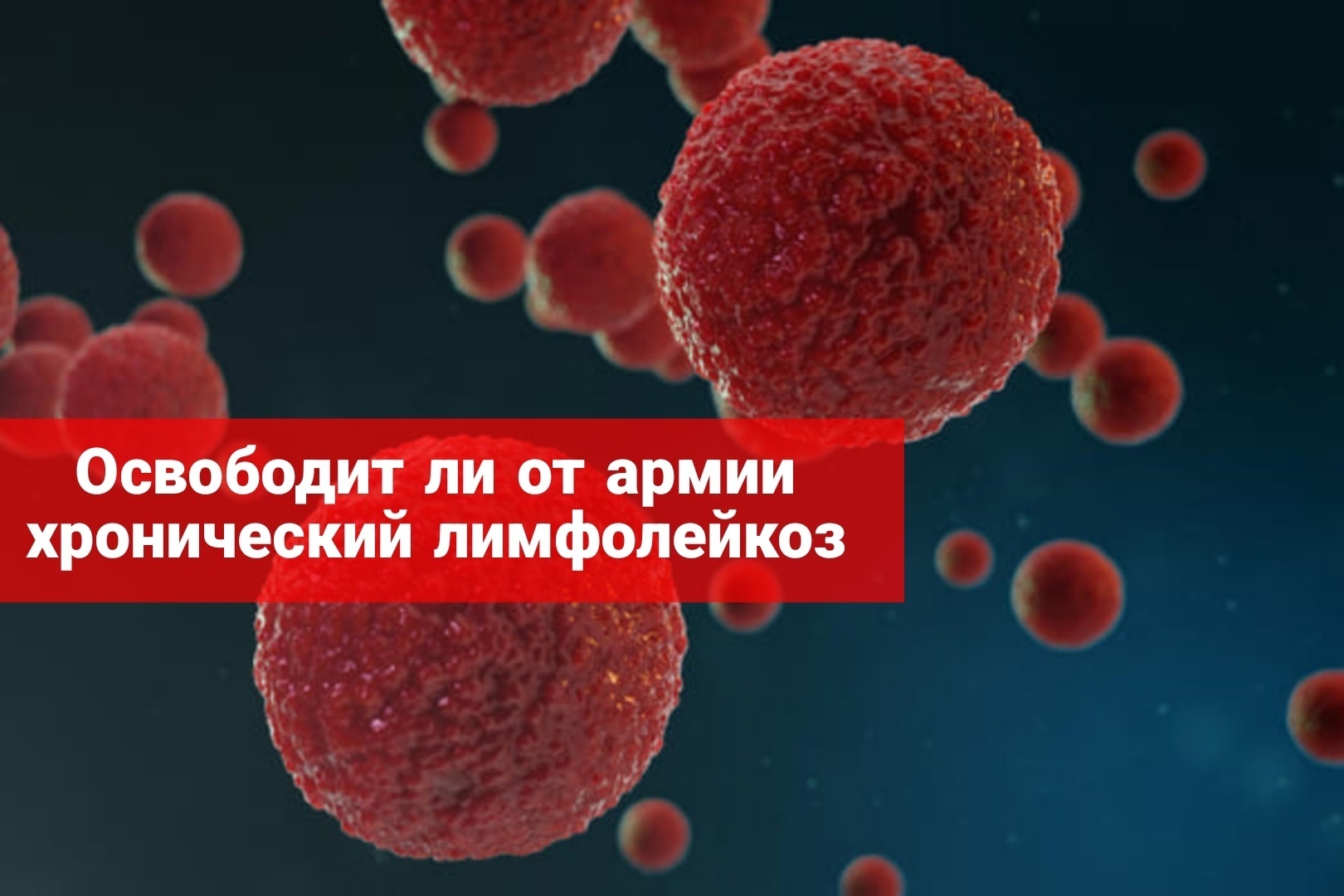 Освободит ли от армии хронический лимфолейкоз