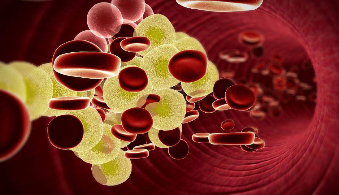 Одна из главных причин появления высокого холестерина.