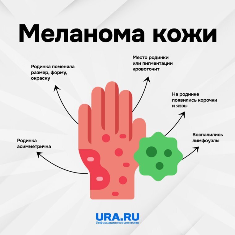 Как распознать рак