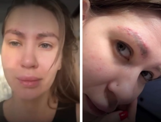 Искусственные брови: новый тренд или путь к катастрофе?