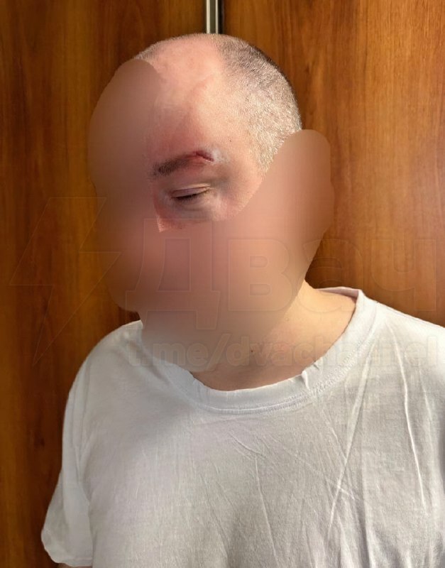 Неправильно понял намек? В Красноярске жена избила мужа вибратором из-за его мысли о «тройничке» с подругой