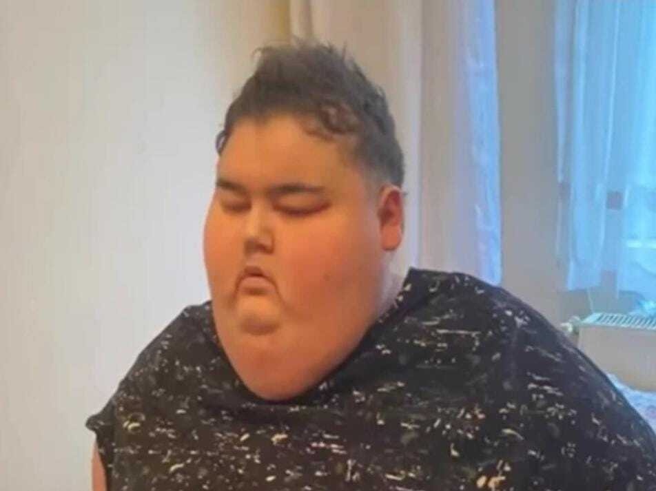 Здоровье — ничто, еда — всё? Турецкий блогер объедался на камеру и скончался от осложнений, вызванных ожирением