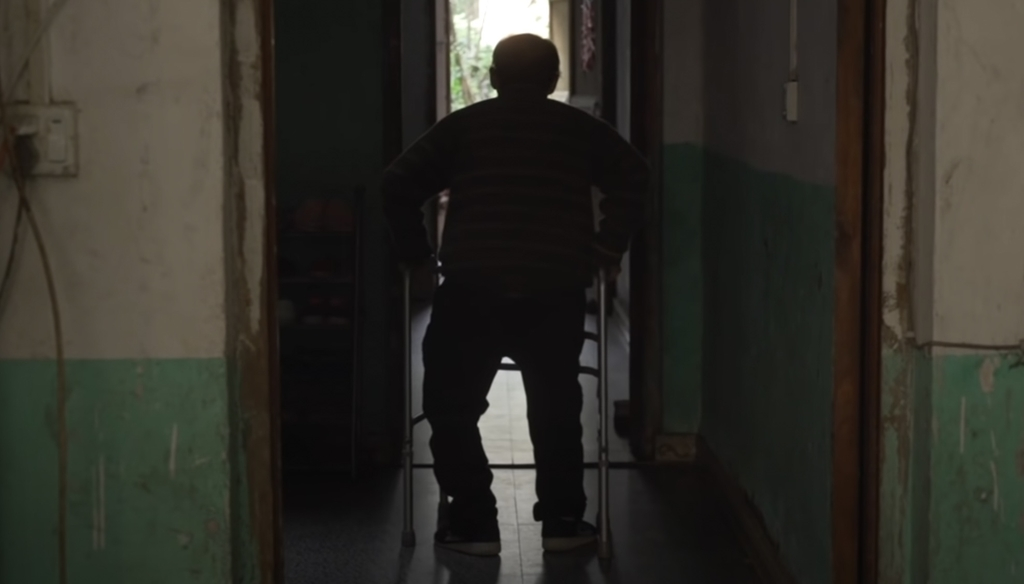 «Сложенный мужчина» выпрямился спустя 28 лет после операции, изменившей его жизнь, из-за редкого заболевания