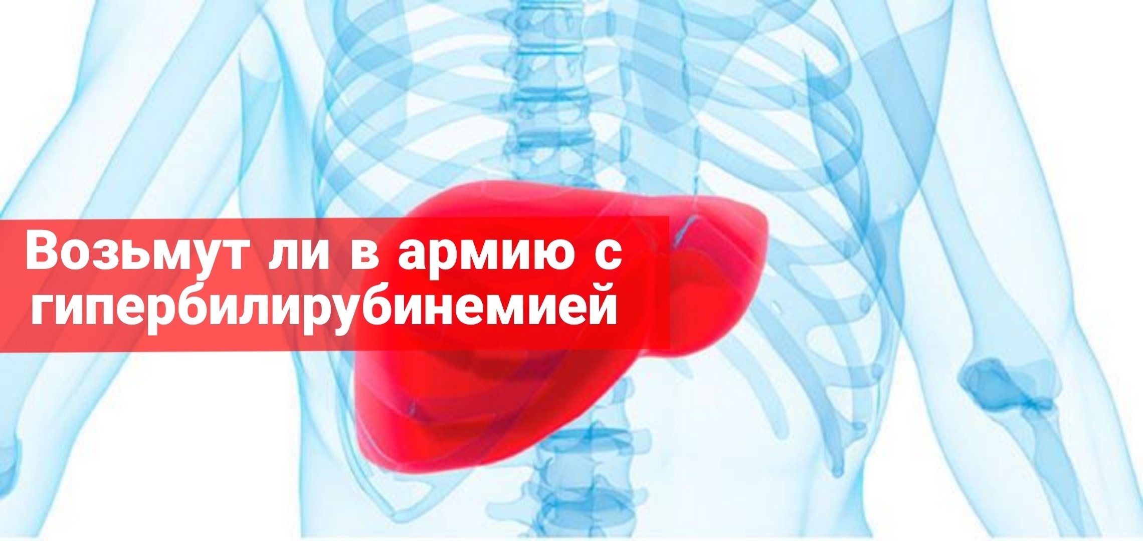 Возьмут ли в армию с гипербилирубинеимией