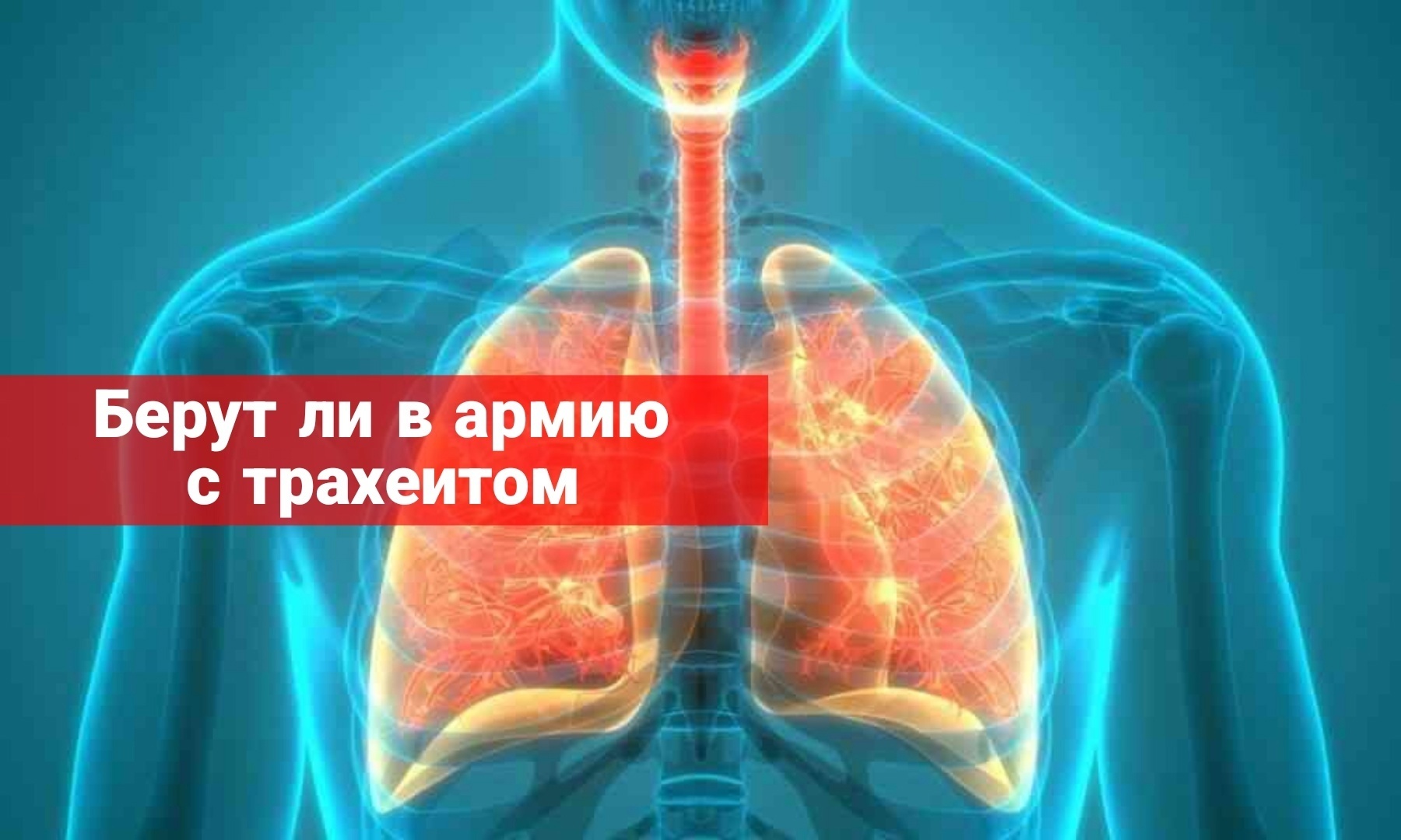Берут ли в армию с трахеитом