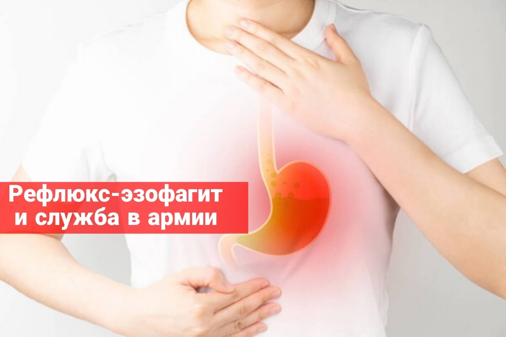 Рефлюкс-эзофагит и служба в армии