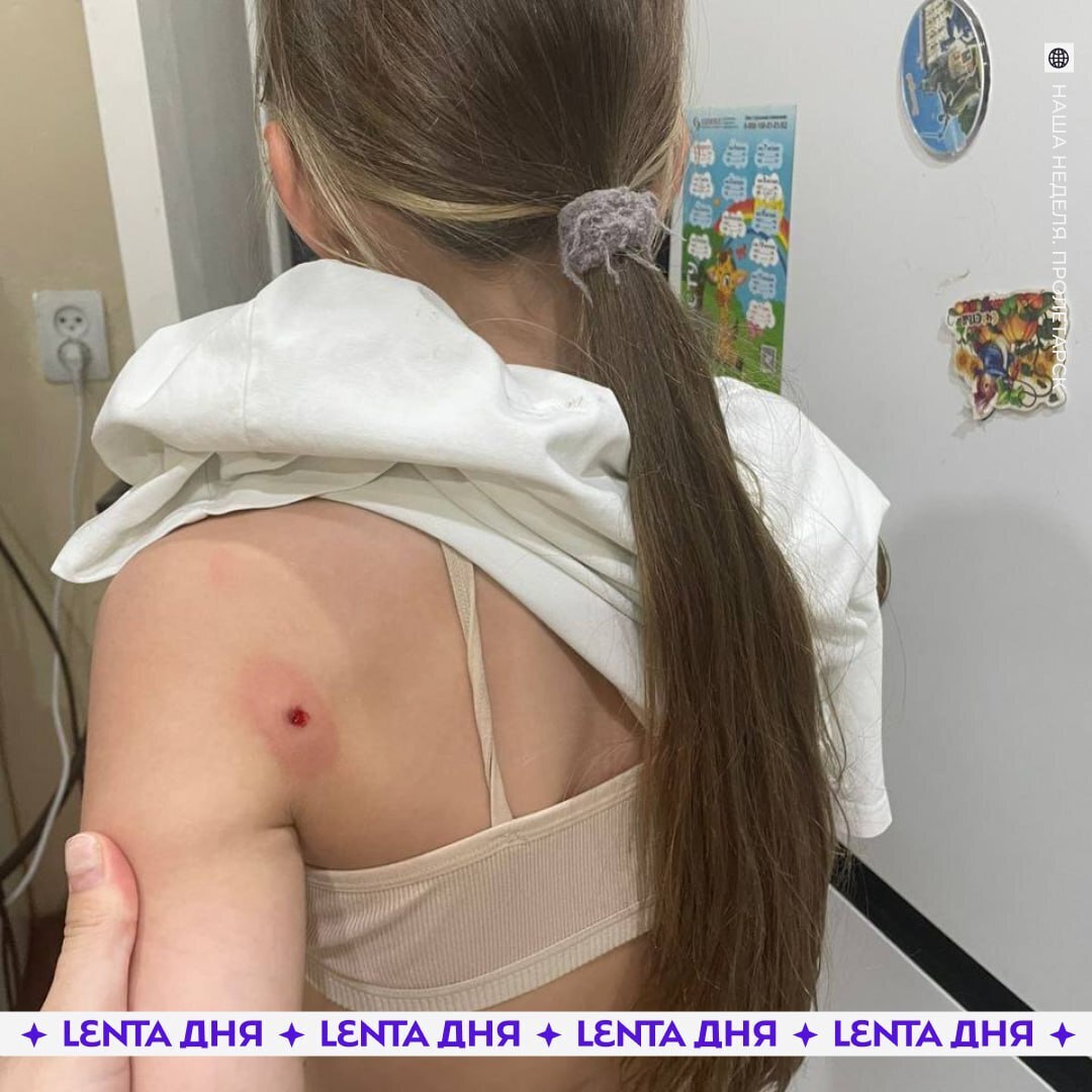 За черешней под дулом винтовки: Дед открыл стрельбу по 13-летним школьницам за попытку сорвать с его дерева несколько черешен